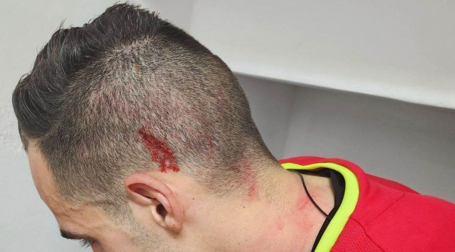 Φτηνά την γλίτωσε ο Εθνικός…