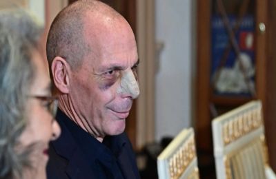 Εμφανή τα χτυπήματα στο πρόσωπο του Βαρουφάκη 