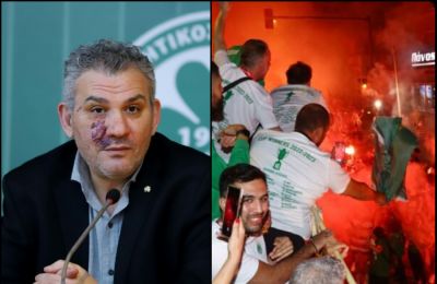 Βολές σε Αστυνομία 