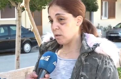 Σήμερα άρχισαν οι εργασίες για τις αλλαγές που απαιτούνται στο εσωτερικό της Καπέλα Σιστίνα