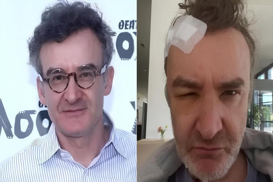 Συγκλονίζει ο Νίκος Ορφανός μετά την αφαίρεση όγκου στο κεφάλι