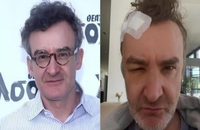 Σε νοσοκομείο του Ανόβερο o Νίκος Ορφανός–Έκανε χειρουργείο αφαίρεσης όγκου από το κεφάλι του