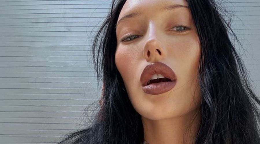 Η Gen Z κάνει αισθητικές επεμβάσεις και το καυχιέται