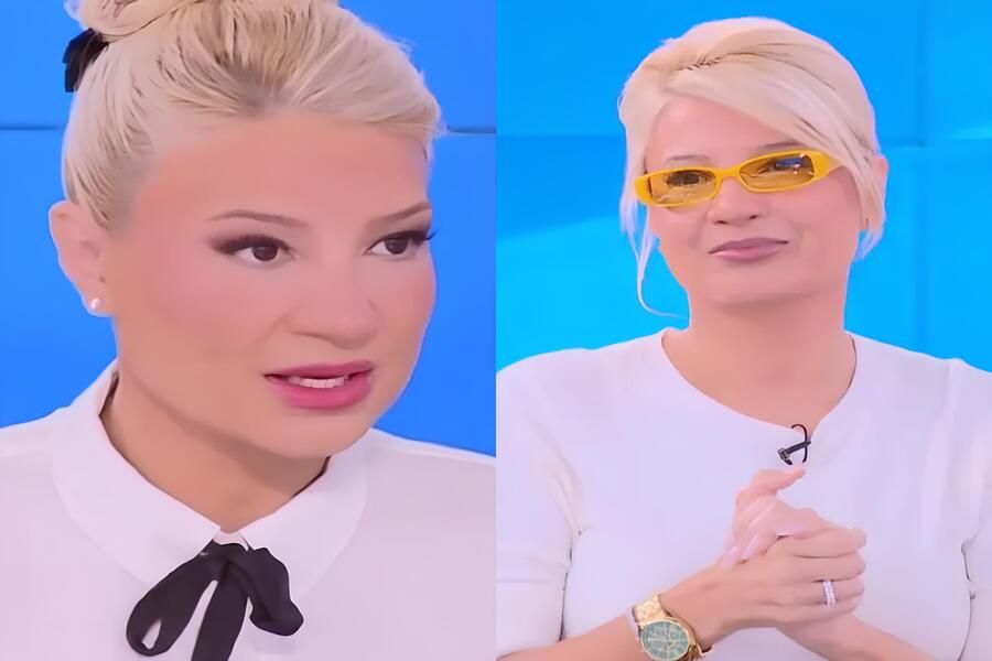 Κερατόκωνος: Η σπάνια πάθηση με την οποία έχει διαγνωσθεί