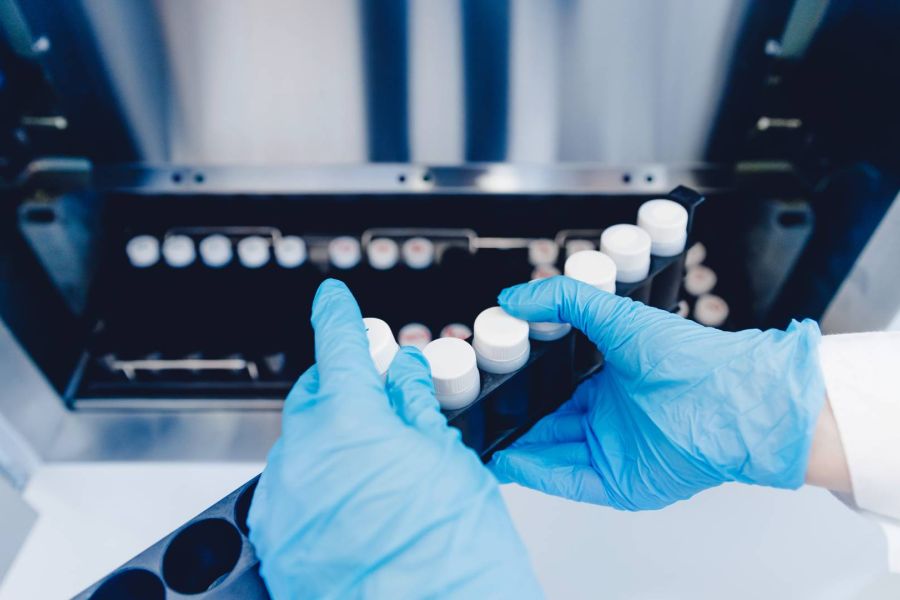 Δωρητής σπέρματος μετέδωσε γονίδιο καρκίνου σε 197 παιδιά