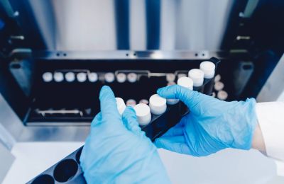 Δωρητής σπέρματος μετέδωσε γονίδιο καρκίνου σε 197 παιδιά