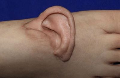 Η Κίνα θέτει νέα παγκόσμια ιατρικά δεδομένα