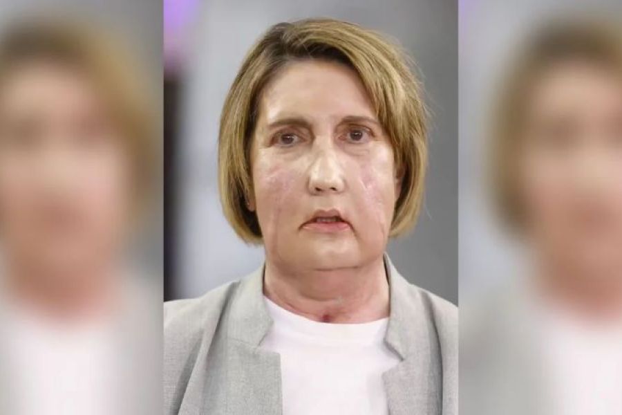 Έ&gamma;&iota;&nu;&epsilon; &eta; &pi;&rho;ώ&tau;&eta; &mu;&epsilon;&tau;&alpha;&mu;ό&sigma;&chi;&epsilon;&upsilon;&sigma;&eta; &pi;&rho;&omicron;&sigma;ώ&pi;&omicron;&upsilon; &mu;&epsilon; &delta;ό&tau;&rho;&iota;&alpha;