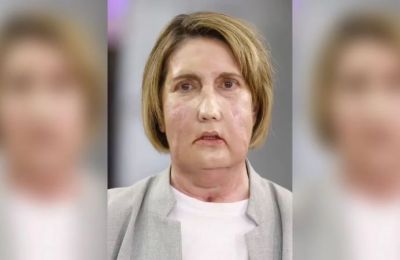 Μία από τις πιο περίπλοκες επεμβάσεις