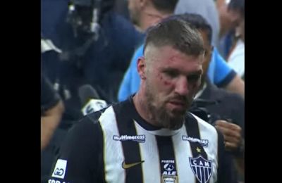 Ο Λιάνκο χτυπήθηκε από 7 διαφορετικούς αντιπάλους