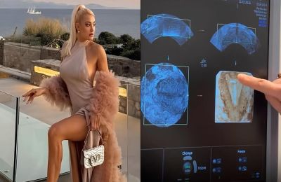 Το υπερηχογράφημα & οι ευχές για εγκυμοσύνη! 