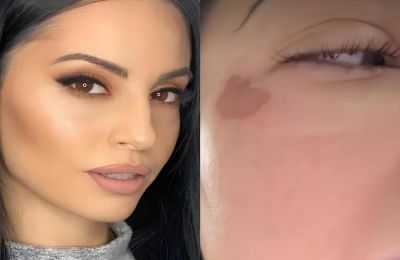 Πρόβλημα υγείας ανήμερα της Ανάστασης