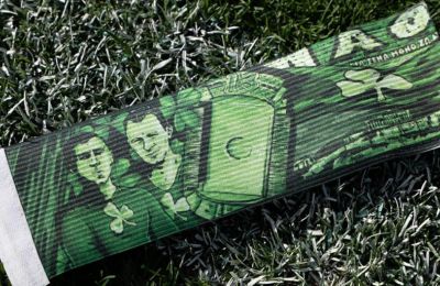 Το ξεχωριστό περιβραχιόνιο που φοράει ο Τσέριν