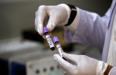Εξέταση αίματος μπορεί να ανιχνεύσει βιοδείκτες που σχετίζονται με τη νόσο Αλτσχάιμερ πολλά χρόνια πριν την εμφάνιση συμπτωμάτων