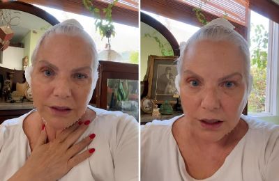 Νανά Παλαιτσάκη: Έκανε λίφτινγκ και το δείχνει δημόσια